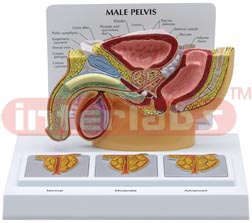 Male Pelvis with 3D Prostate Frame